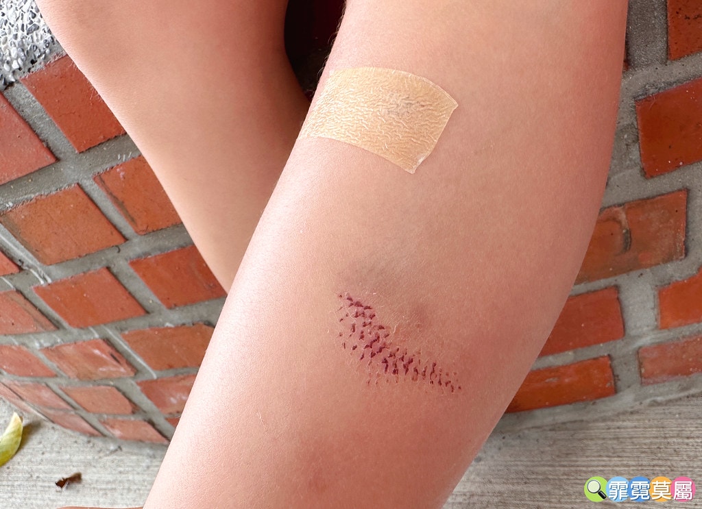 ❤好物分享❤ 康威多愛膚超薄型敷料(人工皮)和愛康膚銀離子敷 S__109895692_0